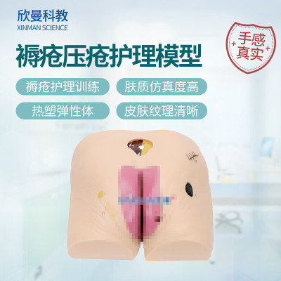 欣曼科教 高级褥疮压疮护理模型 压疮病情演变仿真模型XM-H90