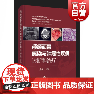 颅颌面骨感染与肿瘤性疾病:诊断和治疗
