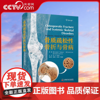 [央视网]骨质疏松性骨折与骨病 由全球著名的骨骼基础研究学者和不同学科的临床专家共同编著 涵盖了骨折后治疗的各个方面ZK